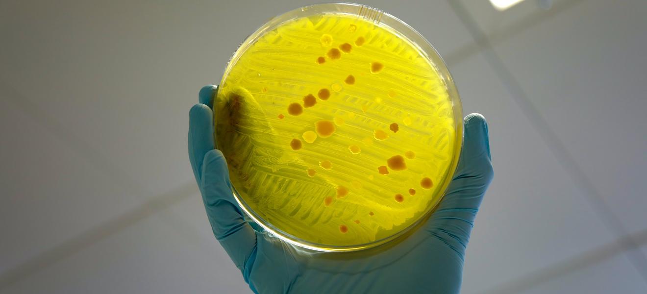 Antimicrobial Resistance Plate